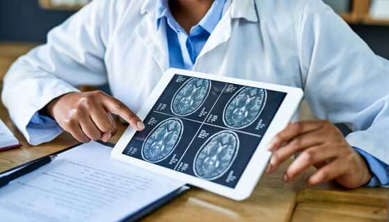 doctor holding brain scans